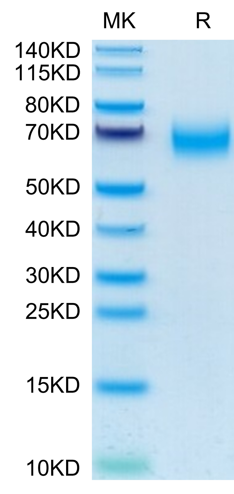 Human CD300A on Tris-Bis PAGE under reduced condition. The purity is greater than 95%.Recombinant Human CD300A Protein, Active
