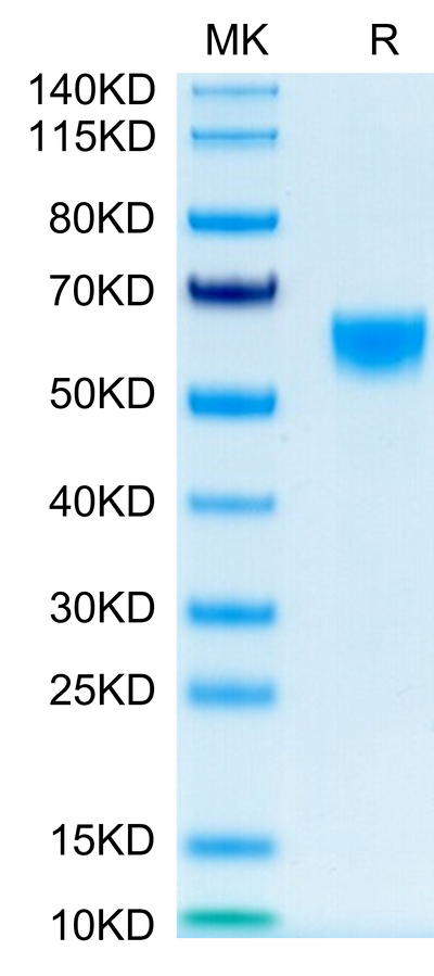 Mouse IL-9 on Tris-Bis PAGE under reduced condition. The purity is greater than 95%.Recombinant Mouse IL-9-Protein