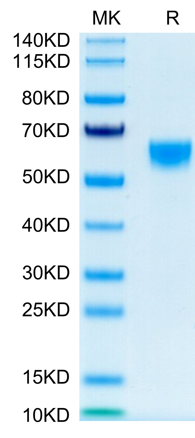 Mouse IL-9 on Tris-Bis PAGE under reduced condition. The purity is greater than 95%.Recombinant Mouse IL-9-Protein