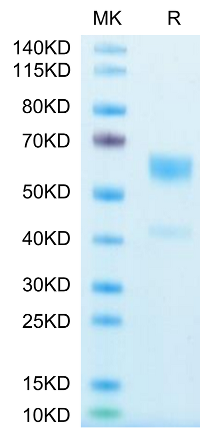 Human IL-9 on Tris-Bis PAGE under reduced condition. The purity is greater than 95%.Recombinant Human IL-9-Protein, Active
