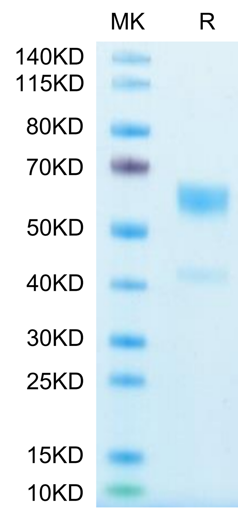 Human IL-9 on Tris-Bis PAGE under reduced condition. The purity is greater than 95%.Recombinant Human IL-9-Protein, Active