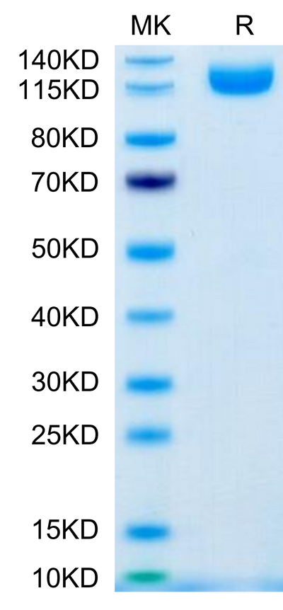 Human IL-31 RA-on Tris-Bis PAGE under reduced condition. The purity is greater than 95%.Recombinant Human IL-31 RA-Protein, Active