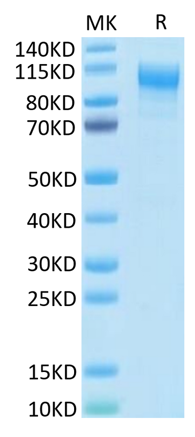 Human IL-31 RA-on Tris-Bis PAGE under reduced condition. The purity is greater than 95%.Recombinant Human IL-31 RA-Protein, Active