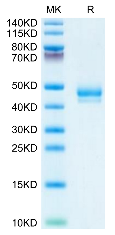 Human GIP on Tris-Bis PAGE under reduced condition. The purity is greater than 95%.Recombinant Human GIP Protein, Active