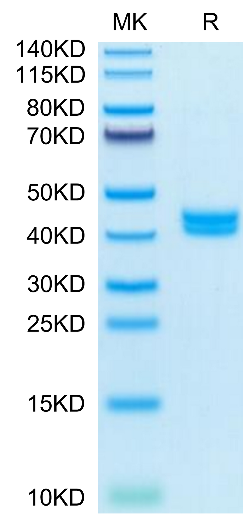 Mouse GIP on Tris-Bis PAGE under reduced condition. The purity is greater than 95%.Recombinant Mouse GIP Protein
