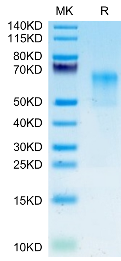 Human GPA on Tris-Bis PAGE under reduced condition. The purity is greater than 95%.Recombinant Human GPA Protein, Active