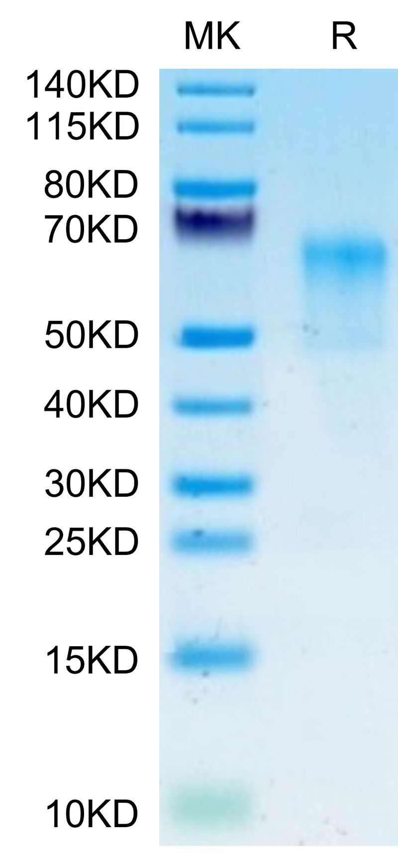 Human GPA on Tris-Bis PAGE under reduced condition. The purity is greater than 95%.Recombinant Human GPA Protein, Active