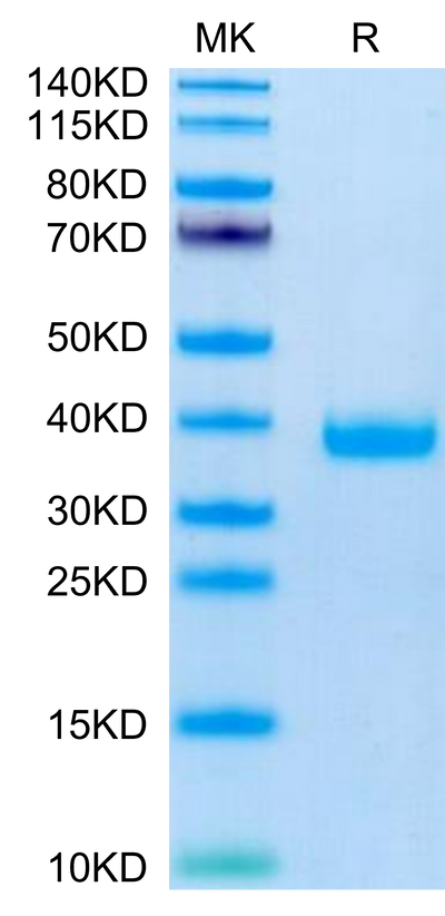 Mouse FSTL3 on Tris-Bis PAGE under reduced condition. The purity is greater than 95%.Recombinant Mouse FSTL3 Protein, Active