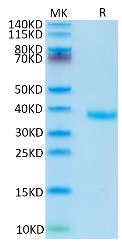 Human FSTL3 on Tris-Bis PAGE under reduced condition. The purity is greater than 95%.Recombinant Human FSTL3 Protein, Active