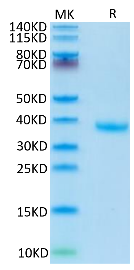 Human FSTL3 on Tris-Bis PAGE under reduced condition. The purity is greater than 95%.Recombinant Human FSTL3 Protein, Active