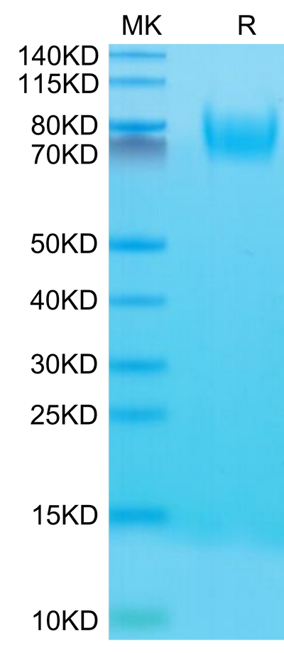 Mouse CD34 on Tris-Bis PAGE under reduced condition. The purity is greater than 95%.Recombinant Mouse CD34 Protein