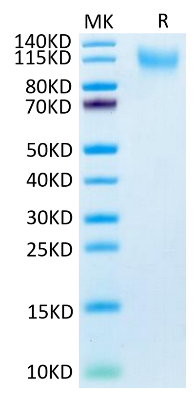 Human CD34 on Tris-Bis PAGE under reduced condition. The purity is greater than 95%.Recombinant Human CD34 Protein, Active