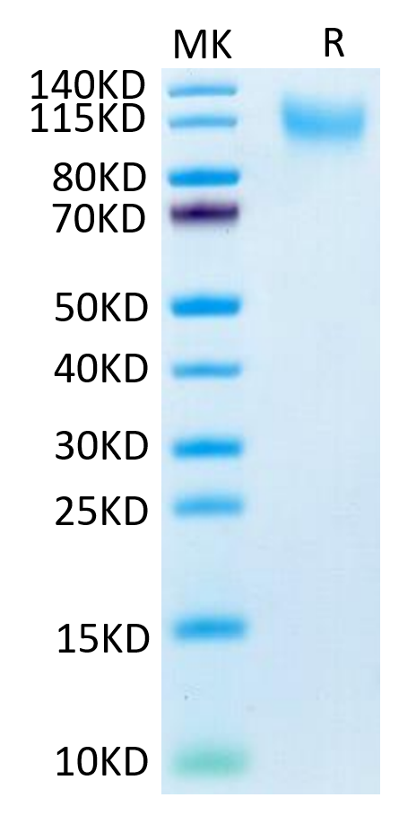 Human CD34 on Tris-Bis PAGE under reduced condition. The purity is greater than 95%.Recombinant Human CD34 Protein, Active