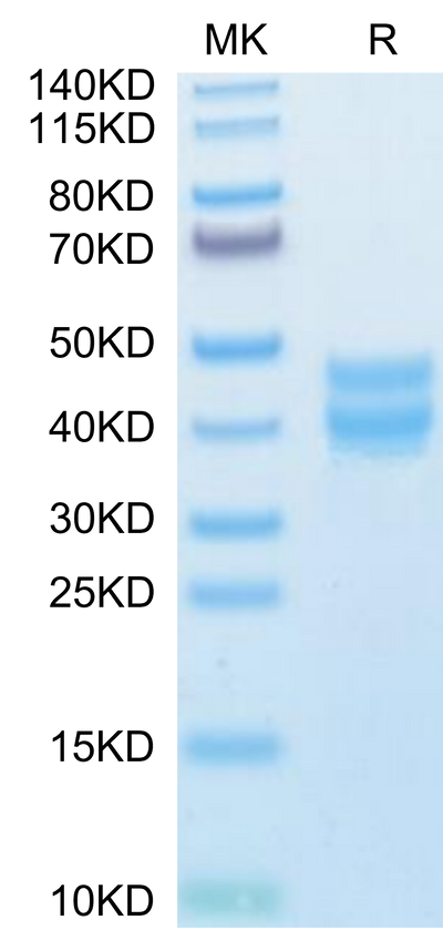 Mouse BST1 on Tris-Bis PAGE under reduced condition. The purity is greater than 95%.Recombinant Mouse BST1 Protein