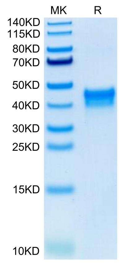Human BST1 on Tris-Bis PAGE under reduced condition. The purity is greater than 95%.Recombinant Human BST1 Protein, Active