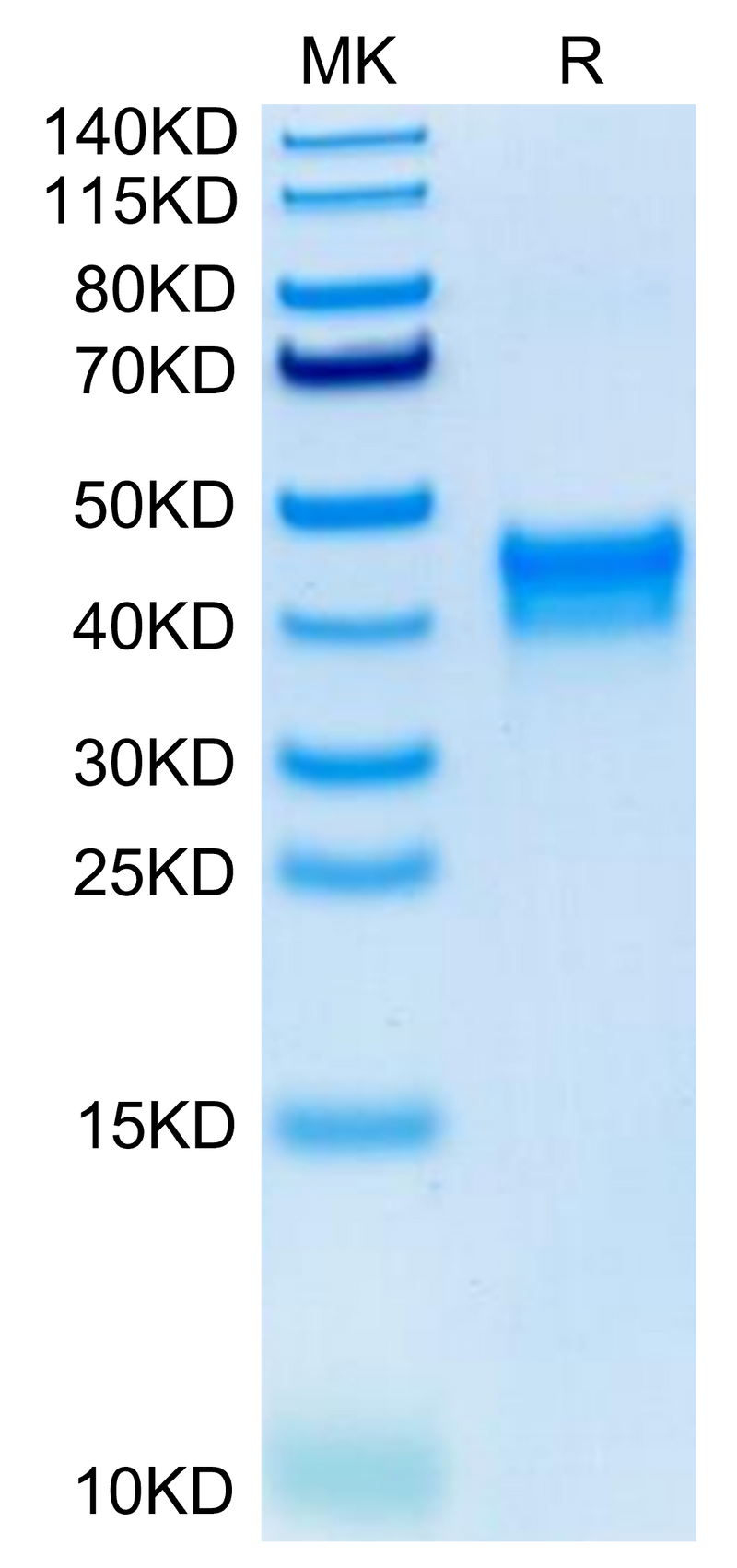 Human BST1 on Tris-Bis PAGE under reduced condition. The purity is greater than 95%.Recombinant Human BST1 Protein, Active