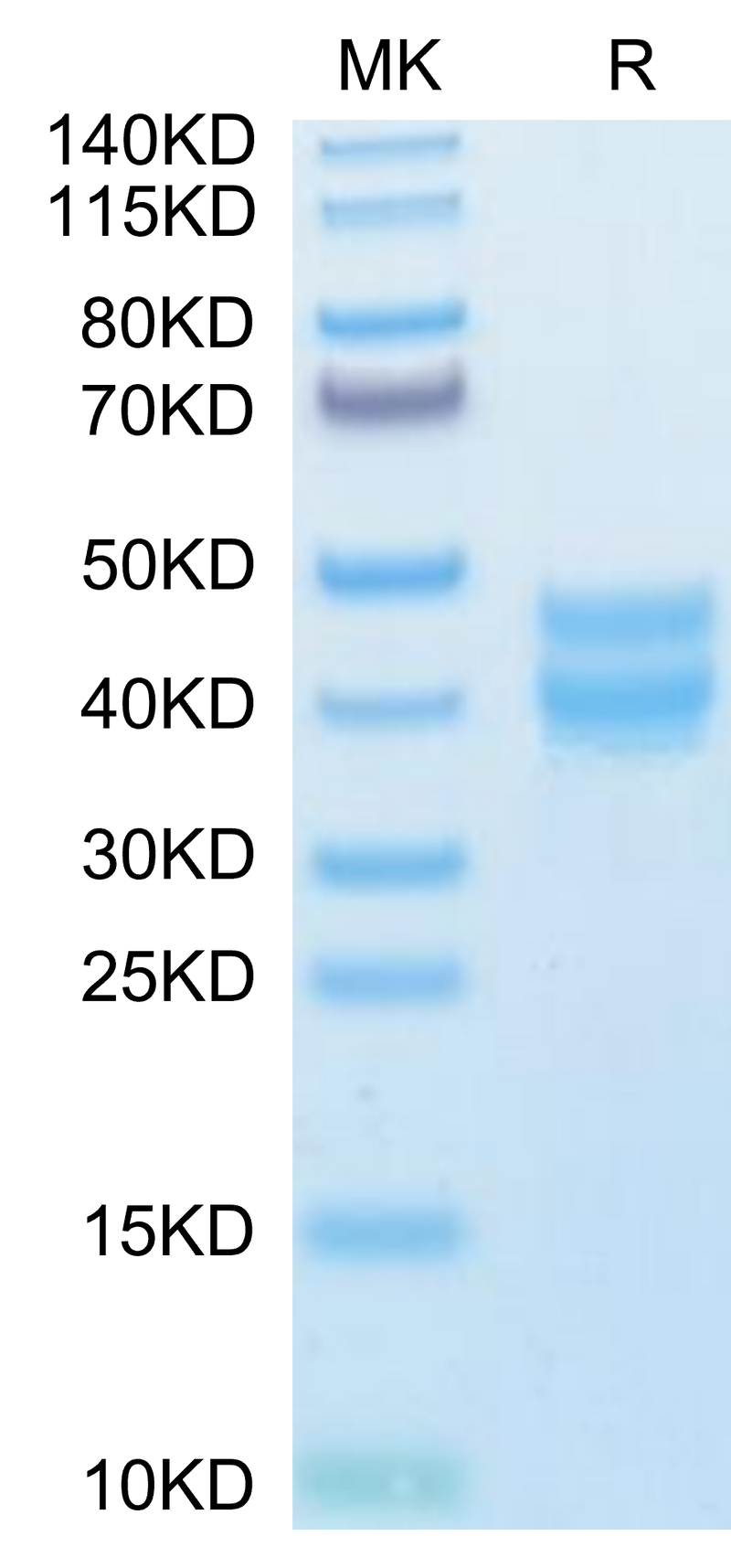 Mouse BST1 on Tris-Bis PAGE under reduced condition. The purity is greater than 95%.Recombinant Mouse BST1 Protein