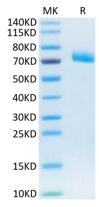 Human IL-12 R beta 1 on Tris-Bis PAGE under reduced condition. The purity is greater than 95%.Recombinant Human IL-12 R beta 1/CD212 Protein, Active