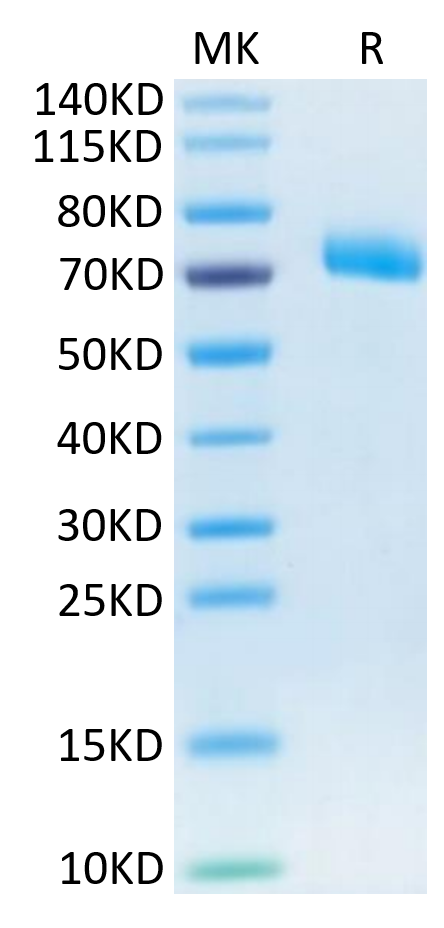 Human IL-12 R beta 1 on Tris-Bis PAGE under reduced condition. The purity is greater than 95%.Recombinant Human IL-12 R beta 1/CD212 Protein, Active