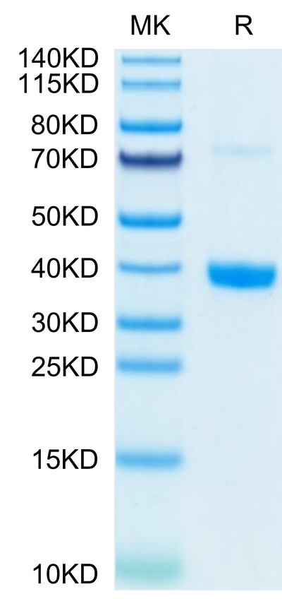 Mouse MFAP4 on Tris-Bis PAGE under reduced condition. The purity is greater than 95%.Recombinant Mouse MFAP4 Protein