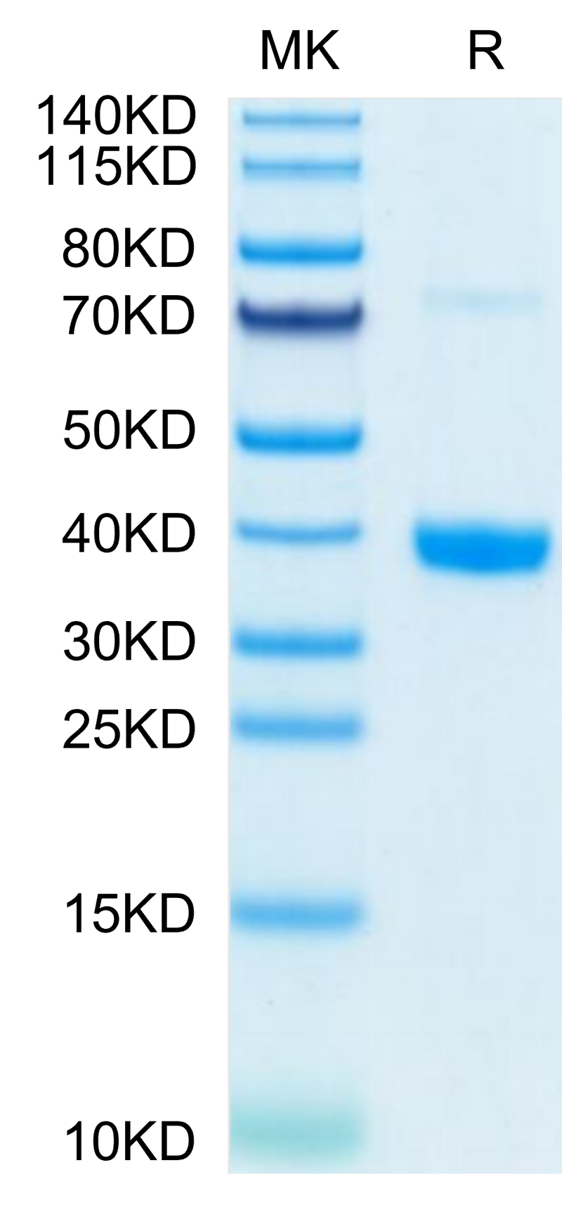 Mouse MFAP4 on Tris-Bis PAGE under reduced condition. The purity is greater than 95%.Recombinant Mouse MFAP4 Protein