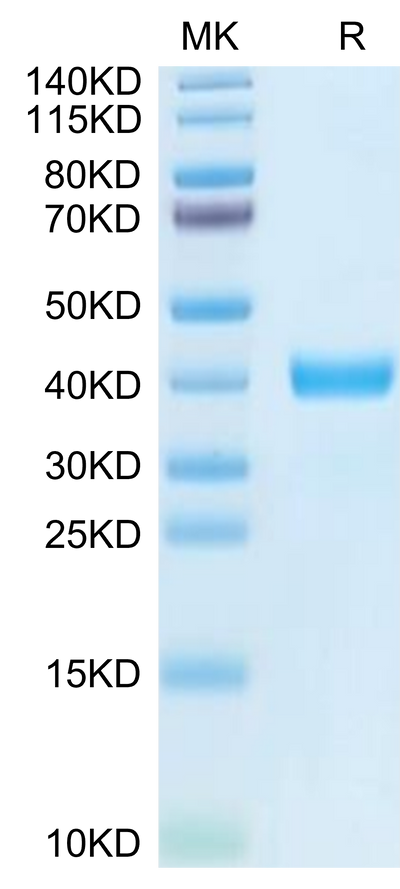 Human MFAP4 on Tris-Bis PAGE under reduced condition. The purity is greater than 95%.Recombinant Human MFAP4 Protein, Active
