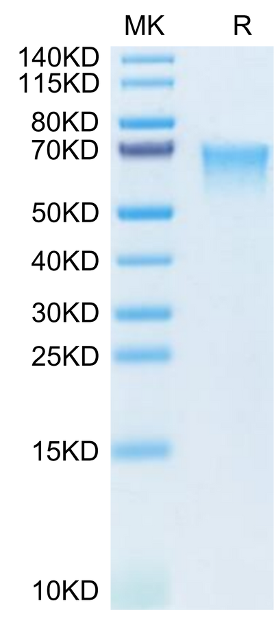 Human MADCAM1 on Tris-Bis PAGE under reduced condition. The purity is greater than 95%.Recombinant Human MADCAM1 Protein, Active
