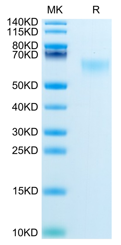 Mouse MADCAM1 on Tris-Bis PAGE under reduced condition. The purity is greater than 95%.Recombinant Mouse MADCAM1 Protein
