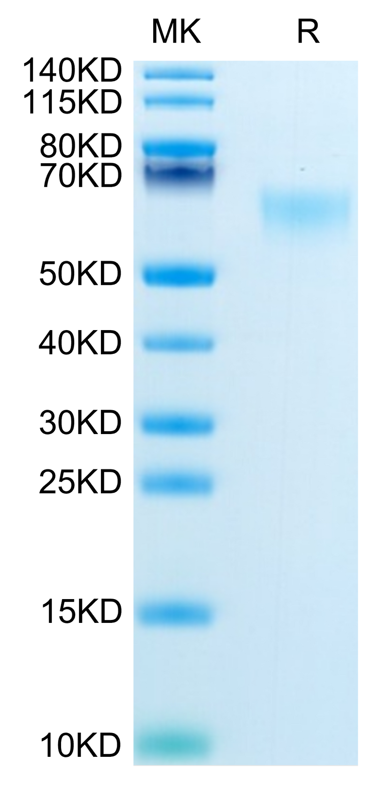 Mouse MADCAM1 on Tris-Bis PAGE under reduced condition. The purity is greater than 95%.Recombinant Mouse MADCAM1 Protein