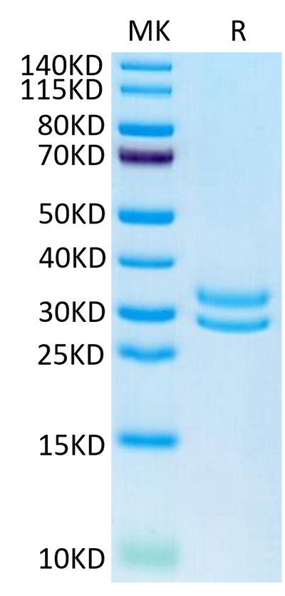 Human JAM-A on Tris-Bis PAGE under reduced condition. The purity is greater than 95%.Recombinant Human JAM-A Protein, Active
