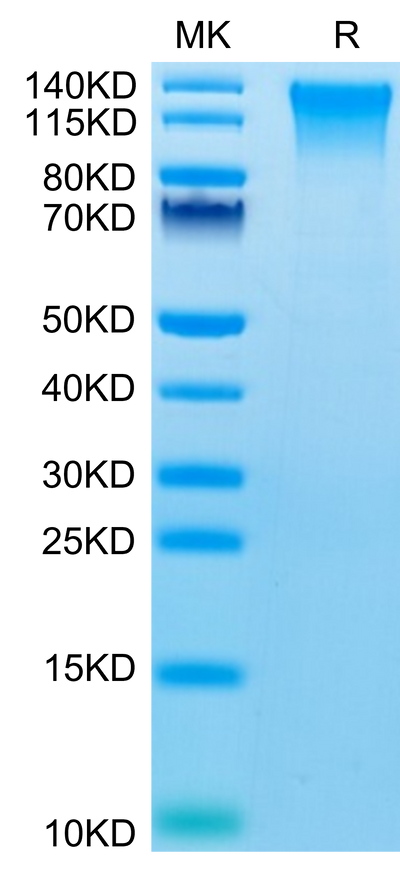 Mouse TEM1 on Tris-Bis PAGE under reduced condition. The purity is greater than 95%.Recombinant Mouse TEM1/cd248 Protein