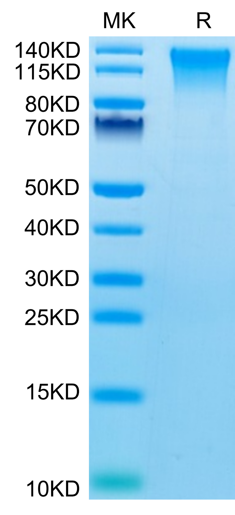 Mouse TEM1 on Tris-Bis PAGE under reduced condition. The purity is greater than 95%.Recombinant Mouse TEM1/cd248 Protein
