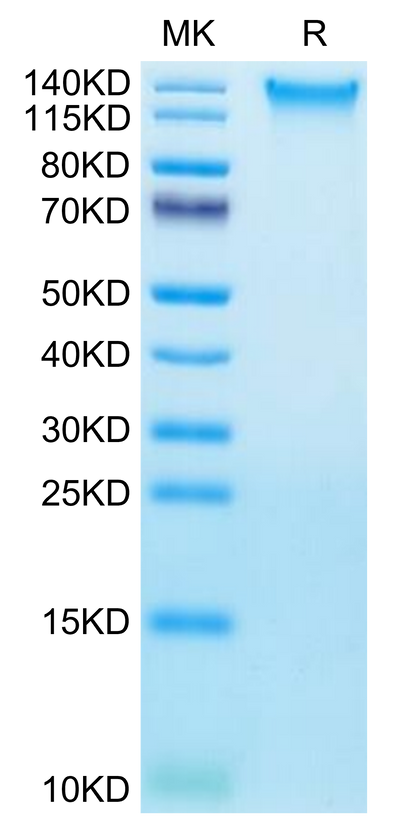 Human TEM1 on Tris-Bis PAGE under reduced condition. The purity is greater than 95%.Recombinant Human TEM1/cd248 Protein, Active