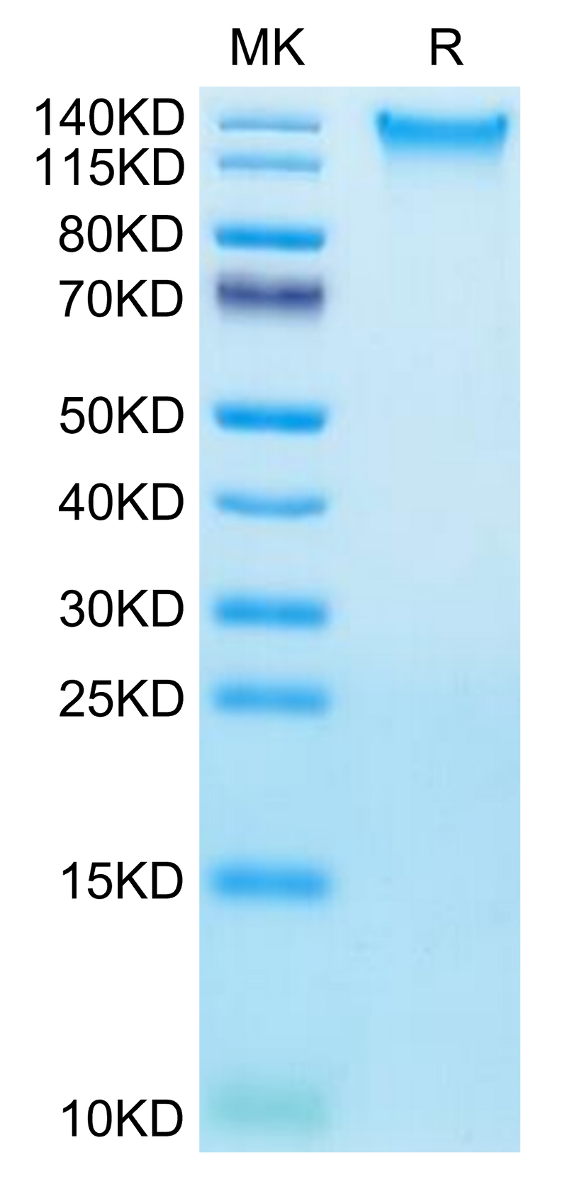 Human TEM1 on Tris-Bis PAGE under reduced condition. The purity is greater than 95%.Recombinant Human TEM1/cd248 Protein, Active
