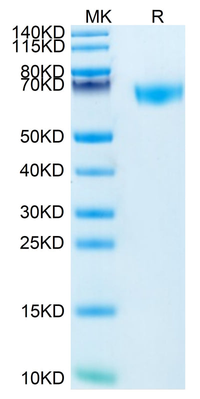 Mouse ROBO4 on Tris-Bis PAGE under reduced condition. The purity is greater than 95%.Recombinant Mouse ROBO4 Protein