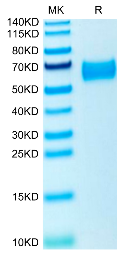Human ROBO4 on Tris-Bis PAGE under reduced condition. The purity is greater than 95%.Recombinant Human ROBO4 Protein, Active