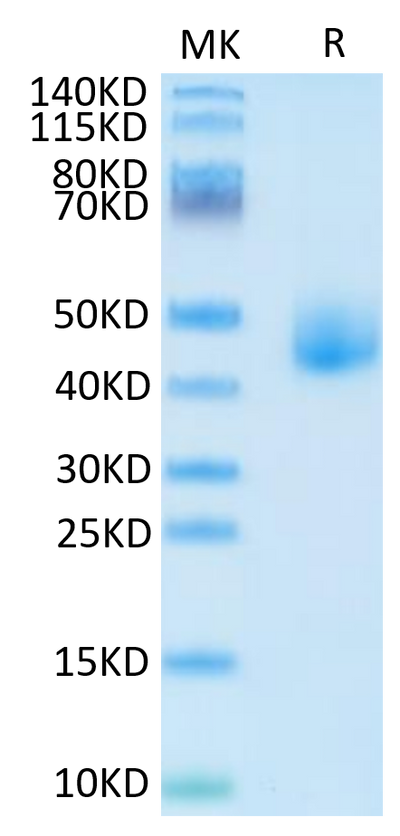 Human DLK1 on Tris-Bis PAGE under reduced condition. The purity is greater than 95%.Recombinant Human DLK1 Protein