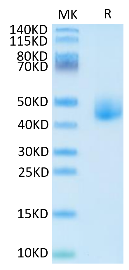 Human DLK1 on Tris-Bis PAGE under reduced condition. The purity is greater than 95%.Recombinant Human DLK1 Protein