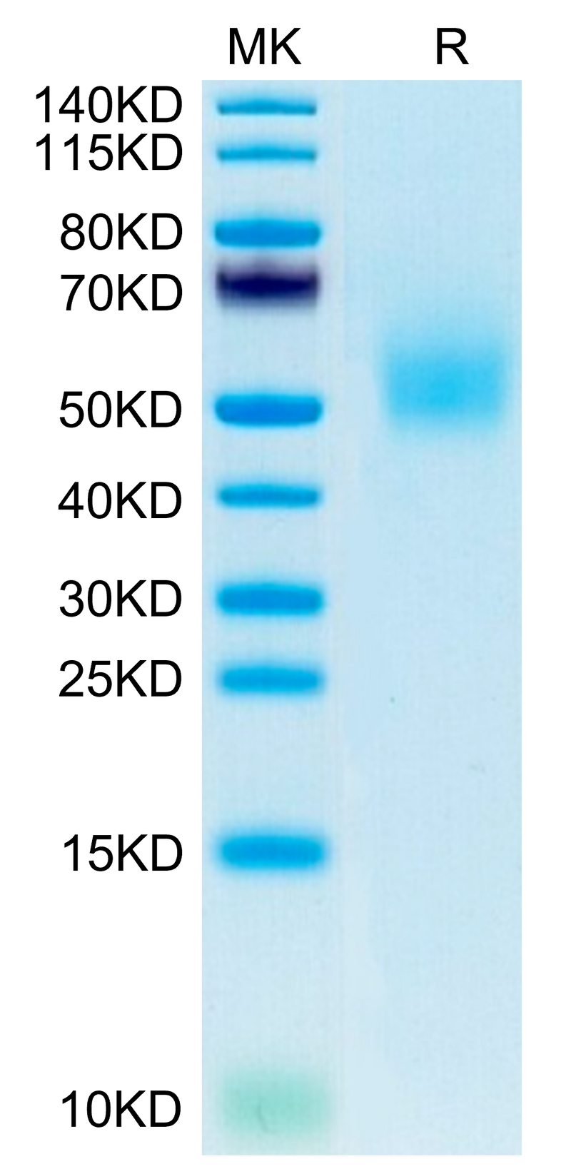Mouse DLK1 on Tris-Bis PAGE under reduced condition. The purity is greater than 95%.Recombinant Mouse DLK1 Protein
