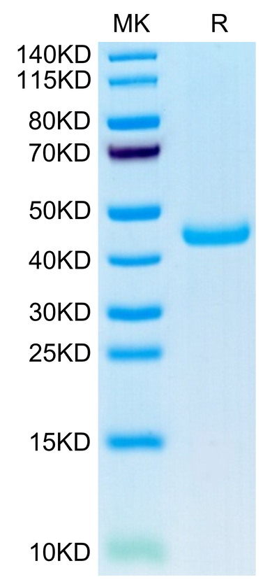 Mouse SPARC on Tris-Bis PAGE under reduced condition. The purity is greater than 95%.Recombinant Mouse SPARC Protein