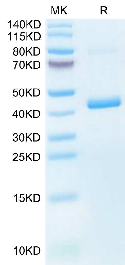 Mouse CXCL4 on Tris-Bis PAGE under reduced condition. The purity is greater than 95%.Recombinant Mouse CXCL4 Protein