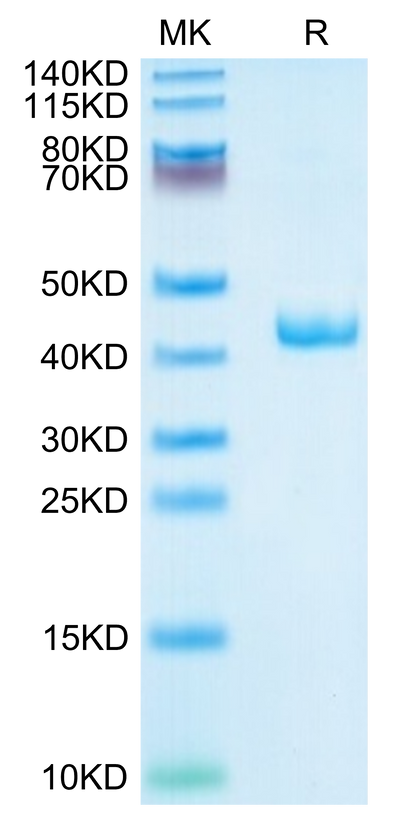 Human CXCL4 on Tris-Bis PAGE under reduced condition. The purity is greater than 95%.Recombinant Human CXCL4 Protein