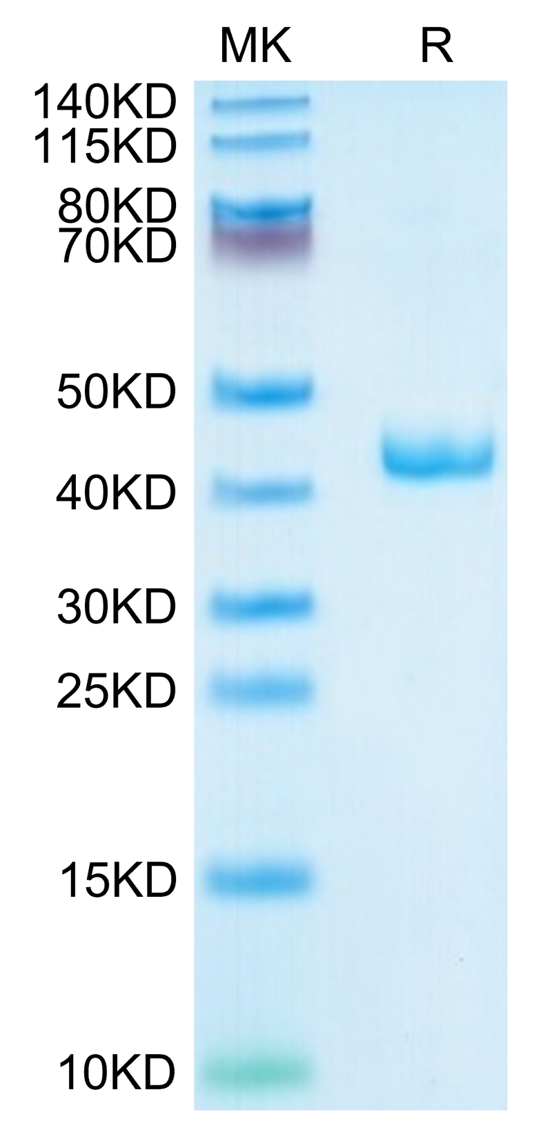 Human CXCL4 on Tris-Bis PAGE under reduced condition. The purity is greater than 95%.Recombinant Human CXCL4 Protein