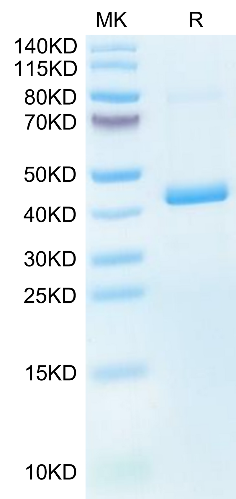 Mouse CXCL4 on Tris-Bis PAGE under reduced condition. The purity is greater than 95%.Recombinant Mouse CXCL4 Protein