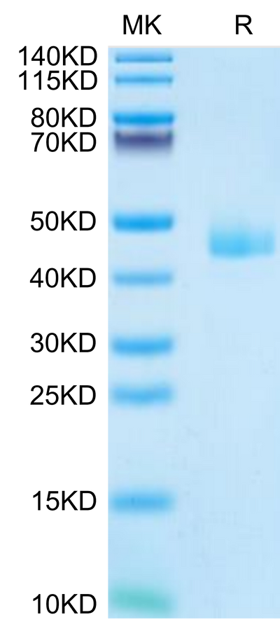 Mouse CCL24 on Tris-Bis PAGE under reduced condition. The purity is greater than 95%.Recombinant Mouse CCL24 Protein