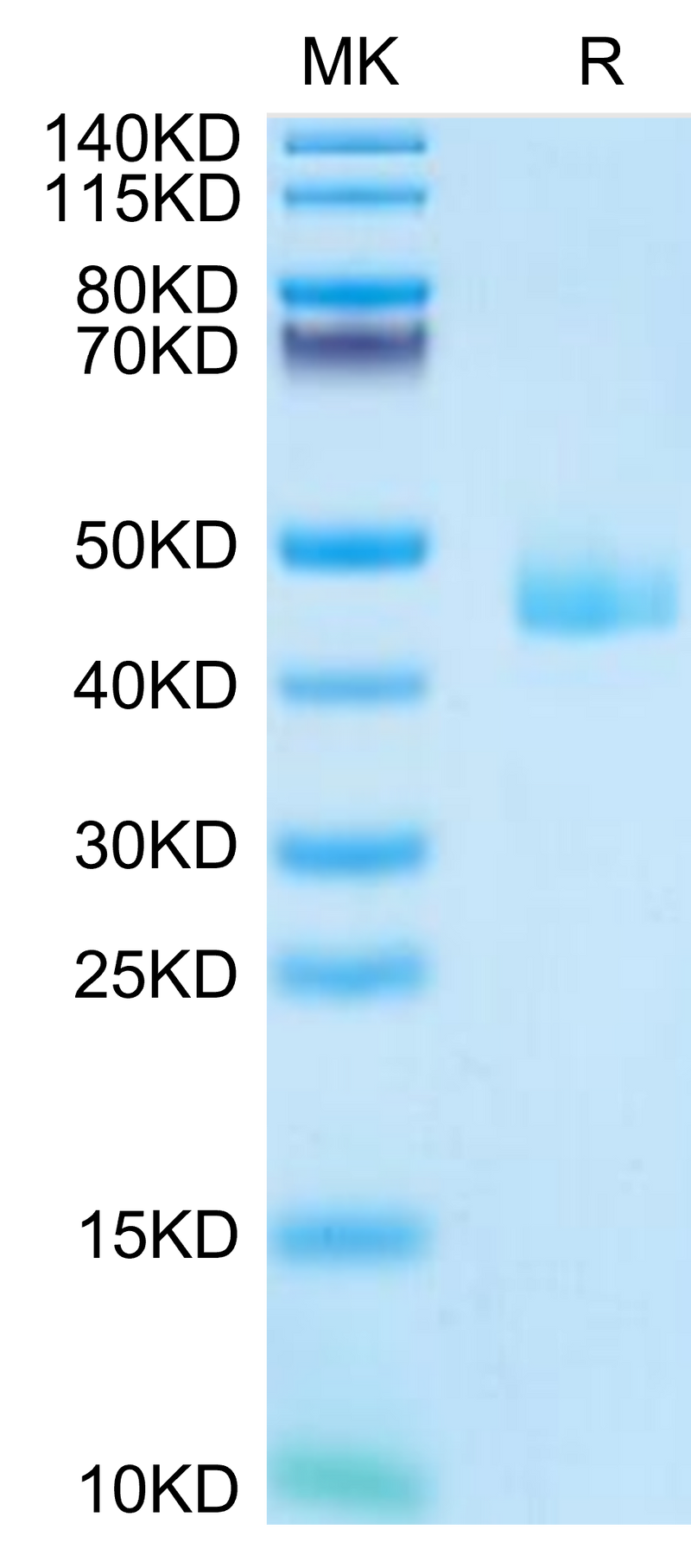 Mouse CCL24 on Tris-Bis PAGE under reduced condition. The purity is greater than 95%.Recombinant Mouse CCL24 Protein