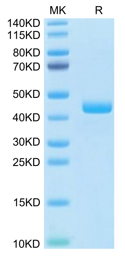 Human CCL24 on Tris-Bis PAGE under reduced condition. The purity is greater than 95%.Recombinant Human CCL24 Protein, Active