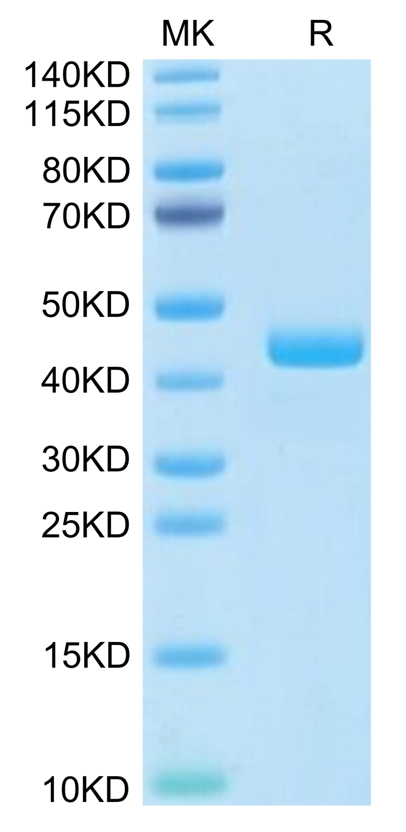 Human CCL24 on Tris-Bis PAGE under reduced condition. The purity is greater than 95%.Recombinant Human CCL24 Protein, Active