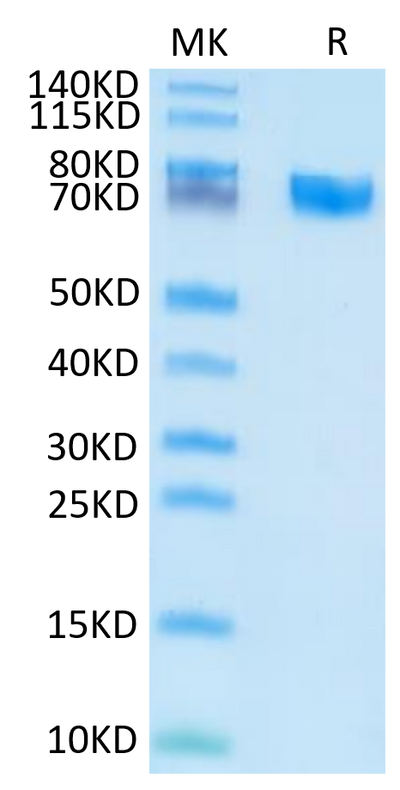 Human EPHA5 on Tris-Bis PAGE under reduced condition. The purity is greater than 95%.Recombinant Human EPHA5 Protein