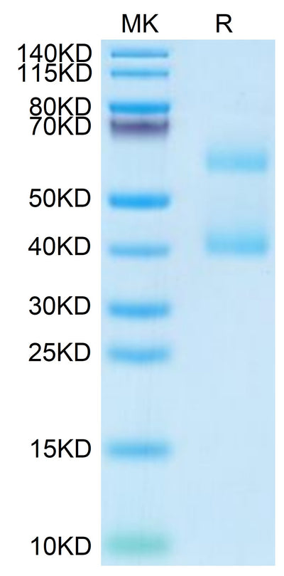Mouse MEPE on Tris-Bis PAGE under reduced condition. The purity is greater than 95%.Recombinant Mouse MEPE Protein